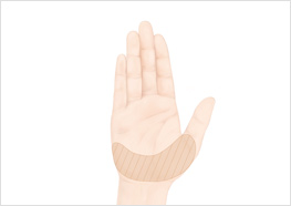 STEP1
