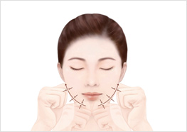 STEP4 - 턱 중앙에서 턱 끝까지 턱 라인을 꼬집듯이 꾹꾹 집어줍니다