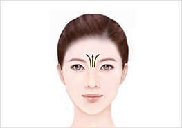 STEP3 - 손가락에 남은 잔여물로 미간 부분을 화살표 방향으로 부드럽게 이완시키고 마무리합니다.