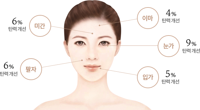 제품 사용 후 미간의 탄력이 6%, 팔자의 탄력이 6%, 이마의 탄력이 4%, 눈가의 탄력이 9%, 입가의 탄력이 5% 개선된 그래프