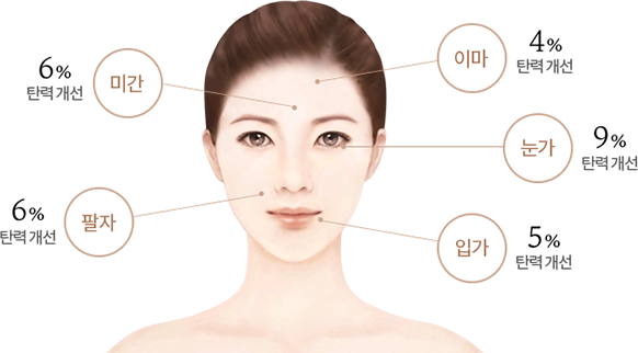 제품 사용 후 미간의 탄력이 6%, 팔자의 탄력이 6%, 이마의 탄력이 4%, 눈가의 탄력이 9%, 입가의 탄력이 5% 개선된 그래프
