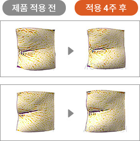 제품 적용 전 / 적용 4주 후 피부 비교