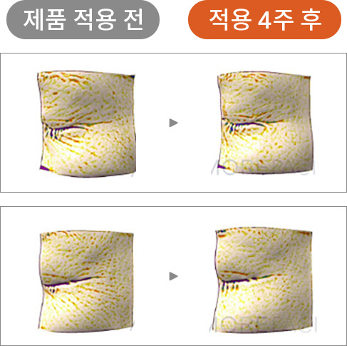 제품 적용 전 / 적용 4주 후 피부 비교