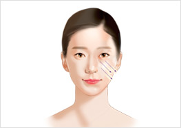 STEP2 - 참고 일러스트