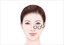 STEP1