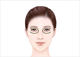 STEP2