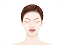 STEP2