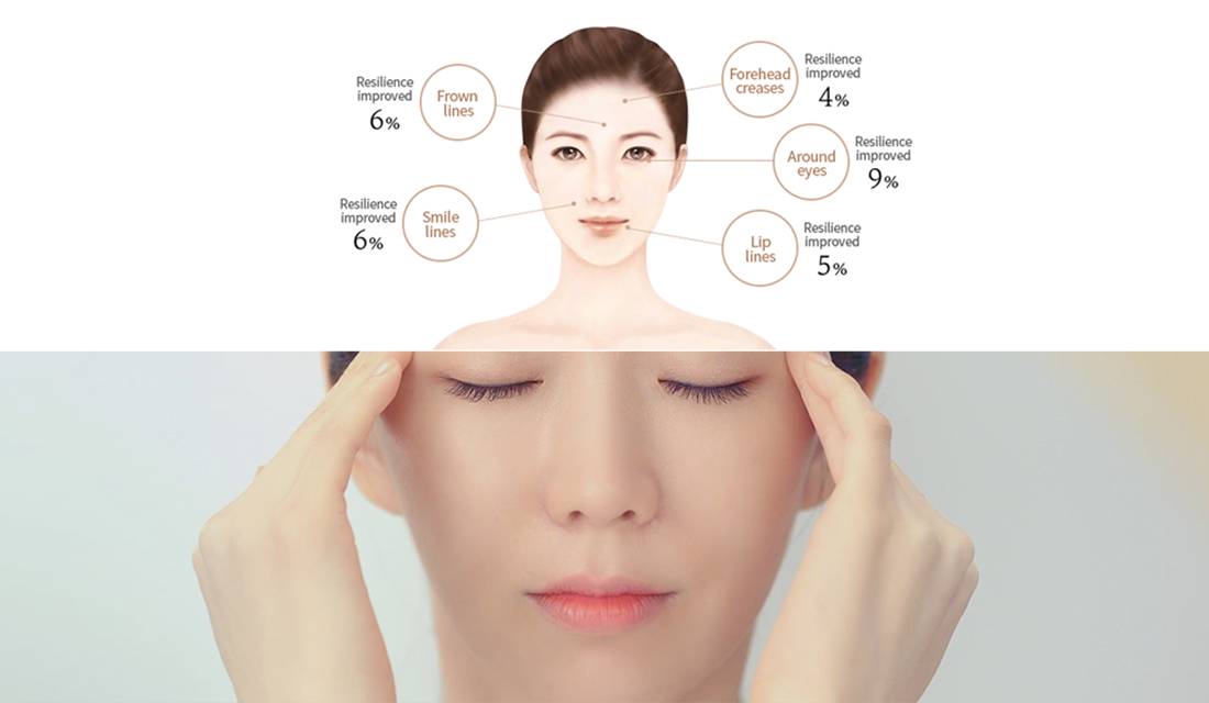이마 4% 탄력개선, 눈가 9% 탄력개선, 입가 5% 탄력개선, 팔자 6% 탄력개선, 미간-6% 탄력개선